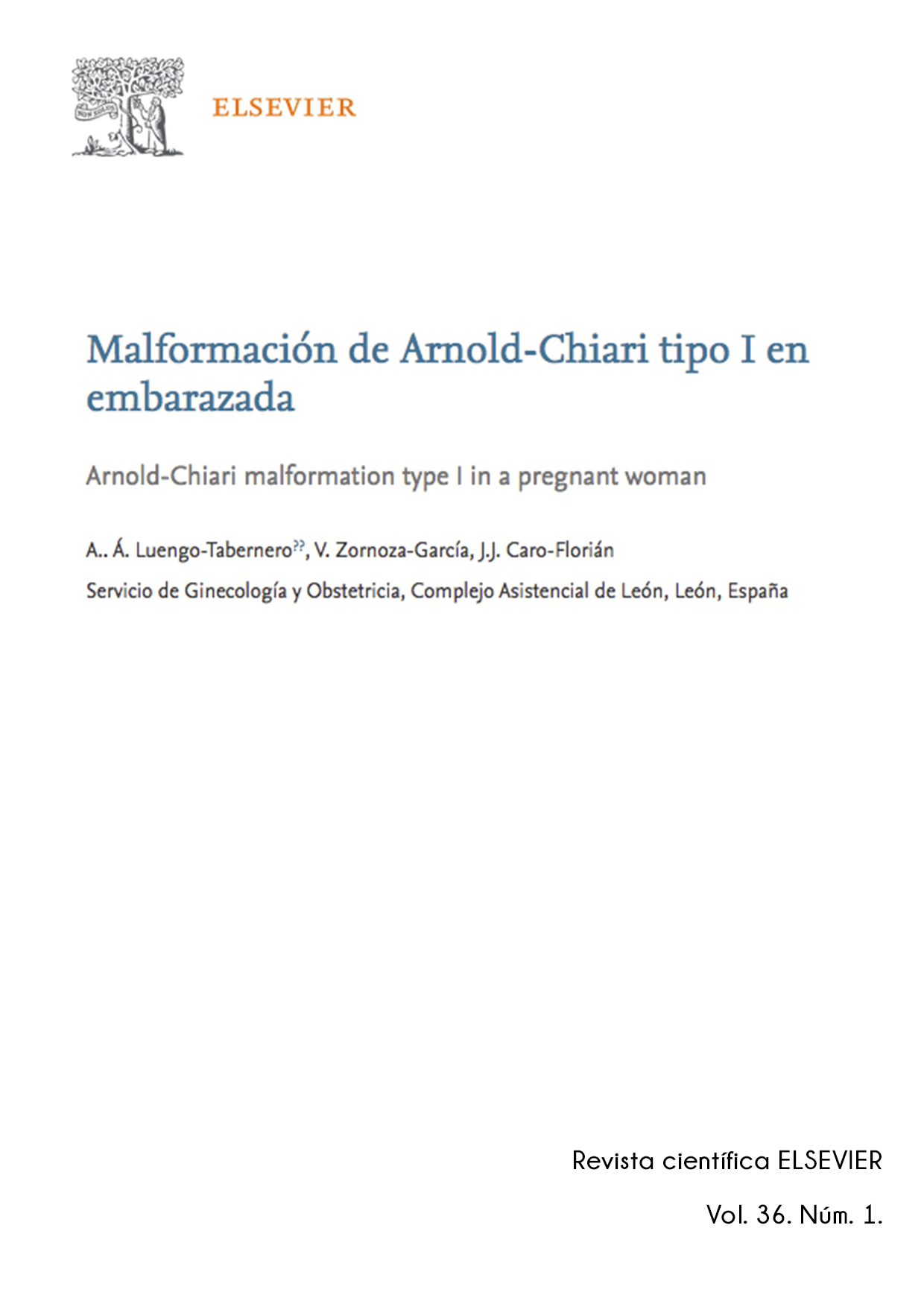 Malformación de Arnold-Chiari tipo I en embarazada Elsevier revista científica